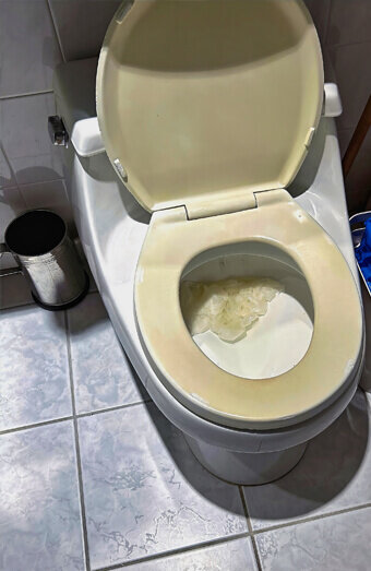 https://blockeddrainsinnaloo.com.au/uploads/2025/07/blocked-toilet-27293.jpg